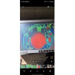 «FlatScan 27» портативті рентгендік теледидар кешені